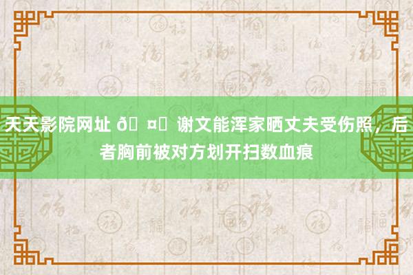 天天影院网址 🤕谢文能浑家晒丈夫受伤照，后者胸前被对方划开扫数血痕